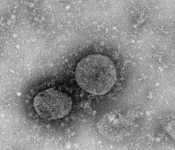 1582211986319046295.jpg gimage002.jpg