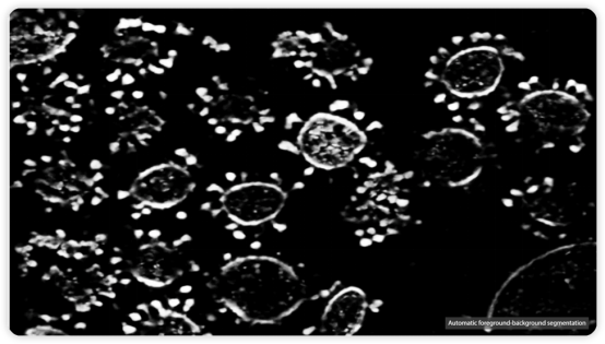 冷冻电子断层扫描的体数据可视化-第十八期可视化与可视分析国际学术报告成功举办2607.png